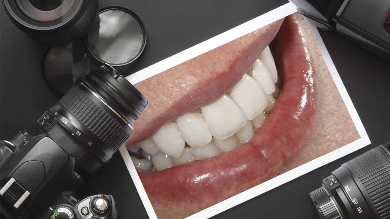 عکاسی-دندانپزشکی
