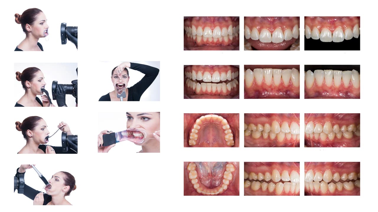 کاربرد تجهیزات در عکاسی از دندان