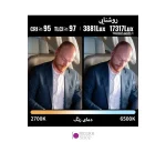 کیت نور ثابت Zhiyun Light Molus X100 Pro - تصویر 15